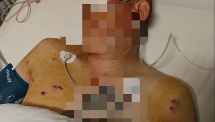 紫牛头条｜男子取款170万在银行门口遭抢劫致重伤，当事人认为银行保安未帮忙应担责