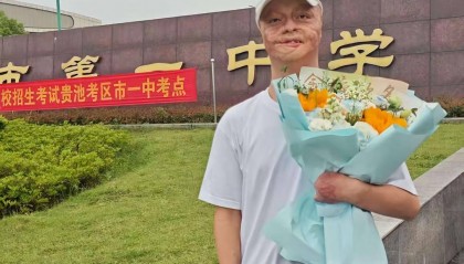 “烧伤男孩”高考664分被东南大学录取:曾经历23次手术,计划未来读研读博