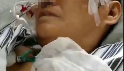 六旬老人遭狩猎者枪击致重伤,开枪者两次逃离现场,事发4小时后冒充“好心人”施救,家属:耽误了最佳救治时间