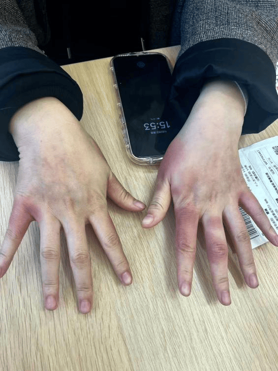 东北姑娘来浙江后崩溃了,穿3条加绒裤还冻到发抖!南方人冬天怎么保命,网友吵翻!