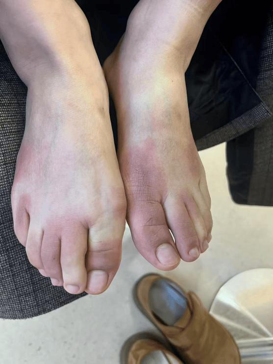 东北姑娘来浙江后崩溃了,穿3条加绒裤还冻到发抖!南方人冬天怎么保命,网友吵翻!