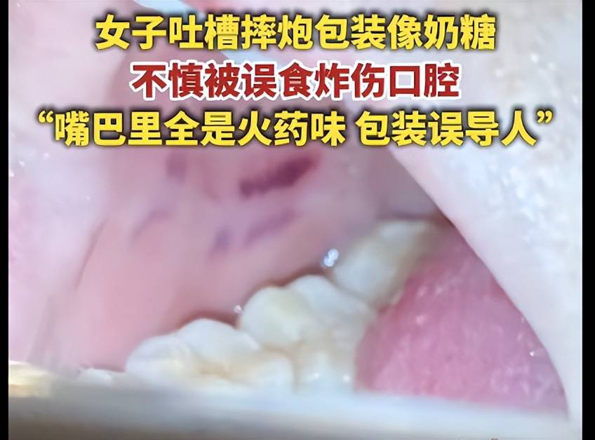 视频画面太揪心！妈妈教扔摔炮玩，幼童误以为是糖，放嘴里咬，瞬间炸了